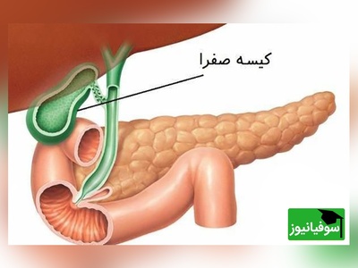 (ویدیو) دکتر علی‌اصغر زنده‌دل: با این میوه کبدتو مثل آب زلال پاک و پاکیزه کن! / توصیه‌های ناب طب سنتی در برنامه «صبحانه ایرانی»